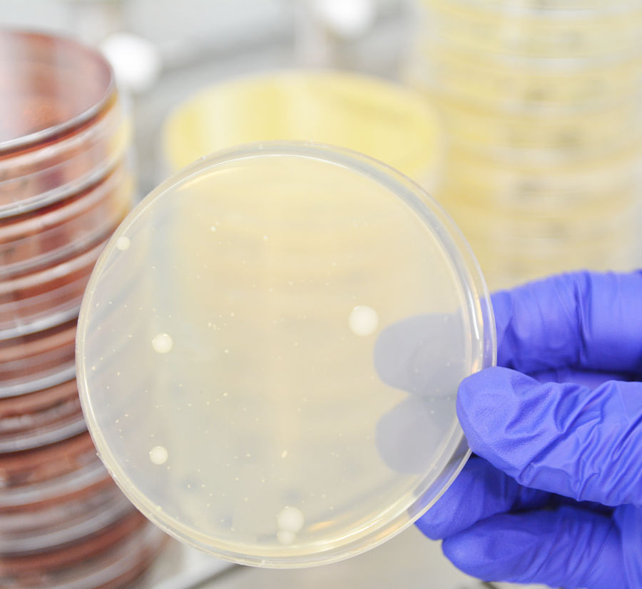 Analisi microbiologiche